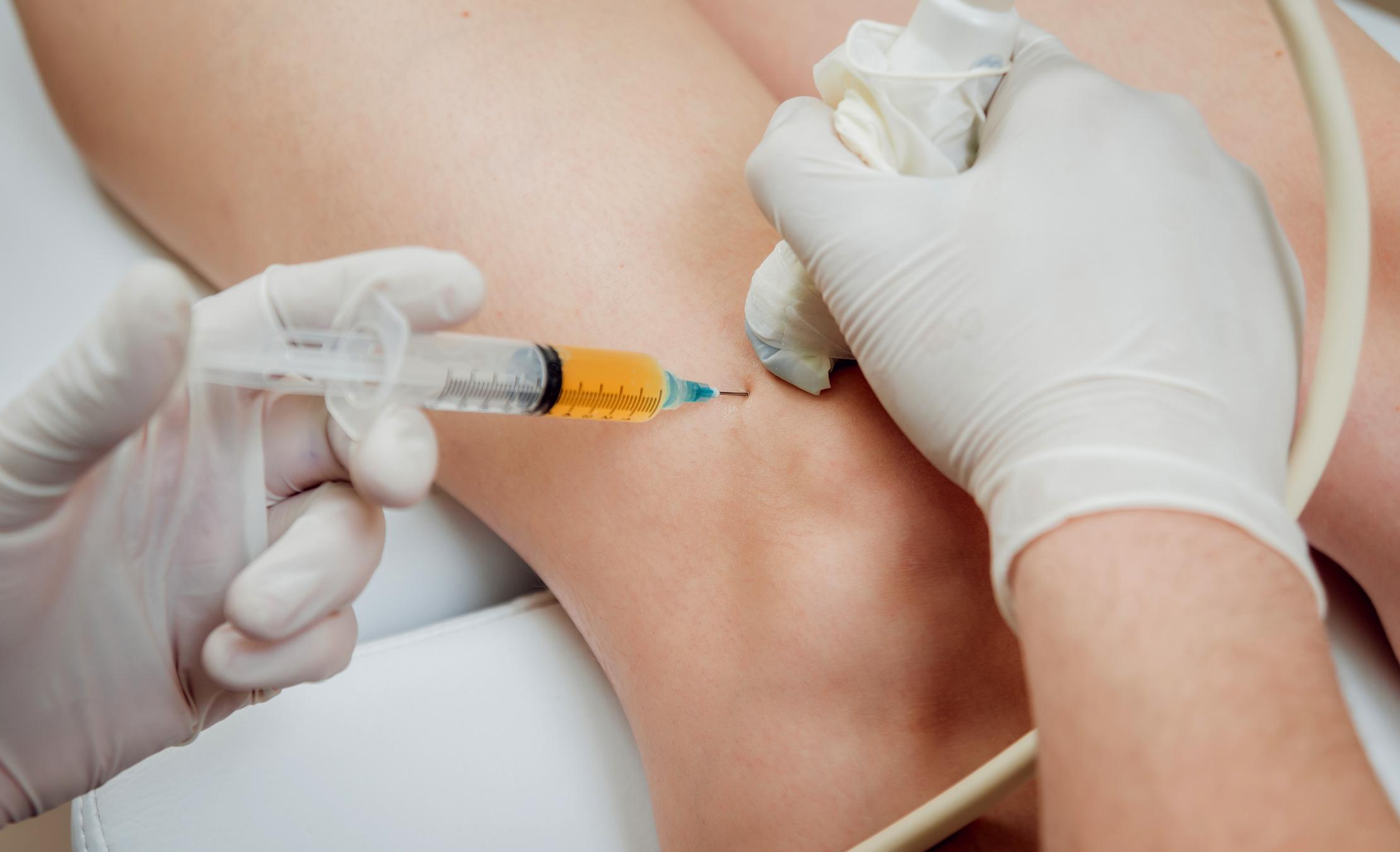 Orthopedic specialist evaluating chronic knee pain